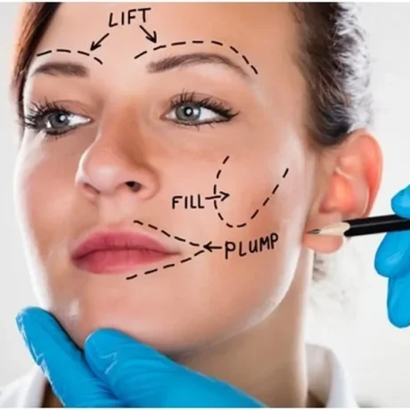 lipofilling facial