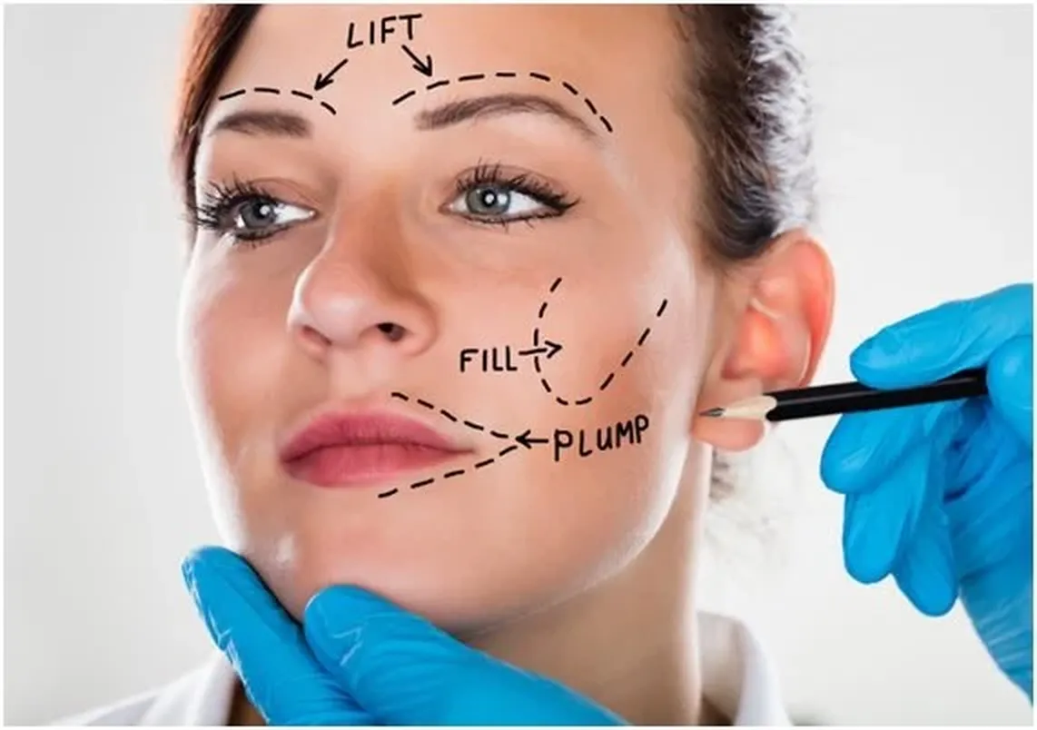 lipofilling facial