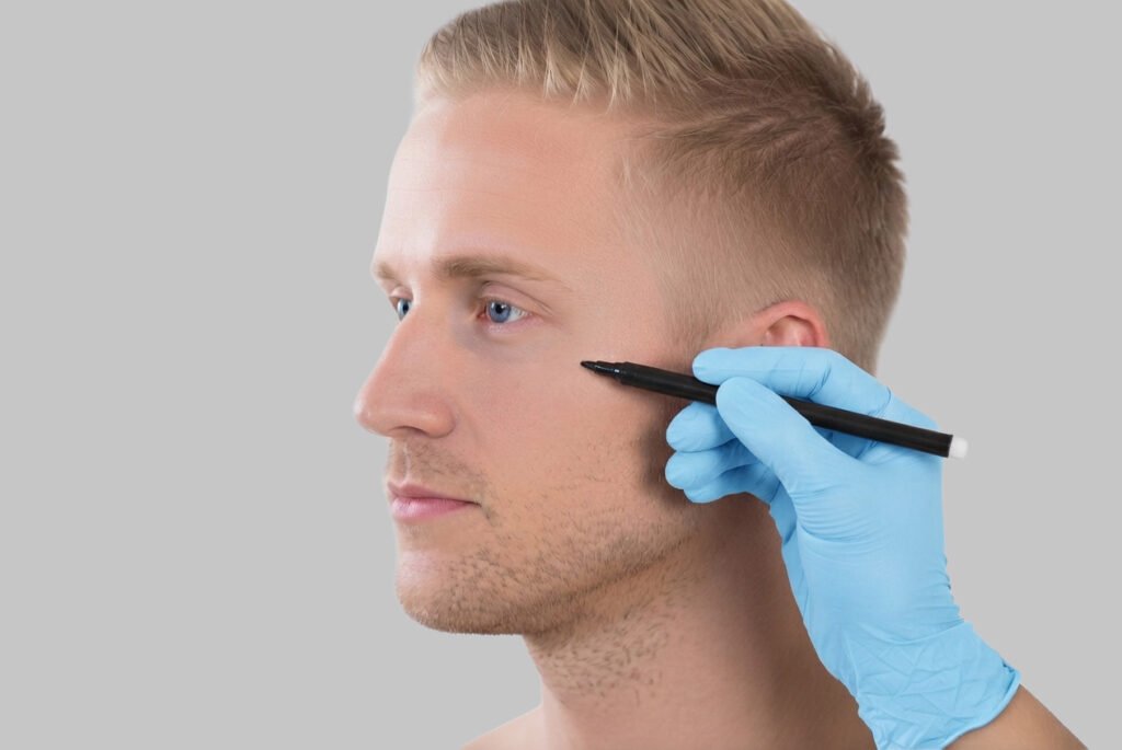 cirugia_facial_hombre