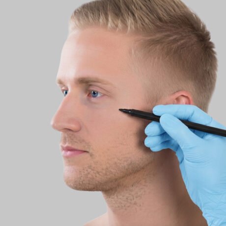 cirugia_facial_hombre