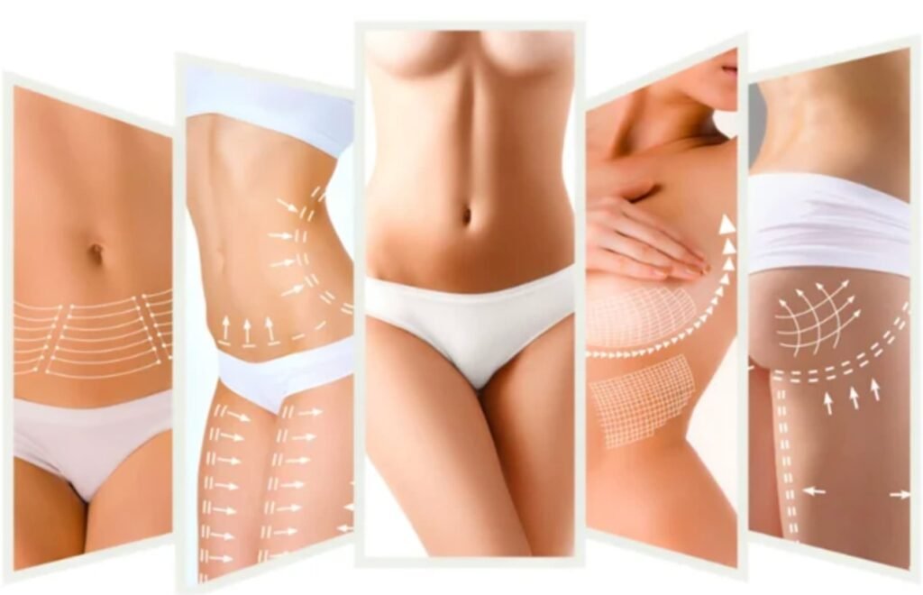 ¿Qué es la lipoabdominoplastia?