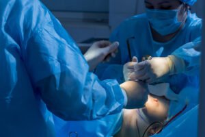 Anomalías en el Pezón: Invertido, Hipertrofia y Dilatación de las Areolas