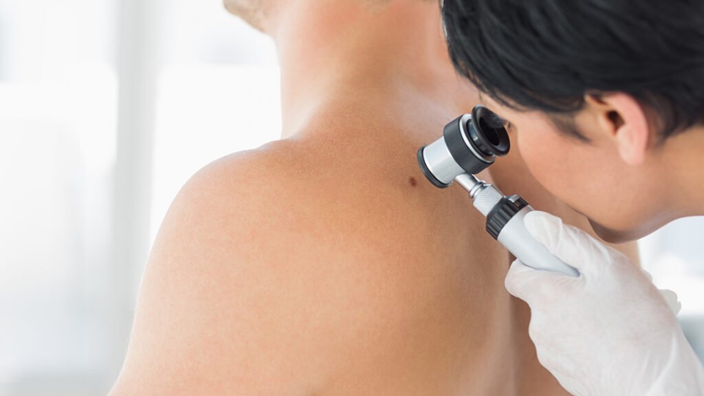 cirugia-para-cancer-de-piel