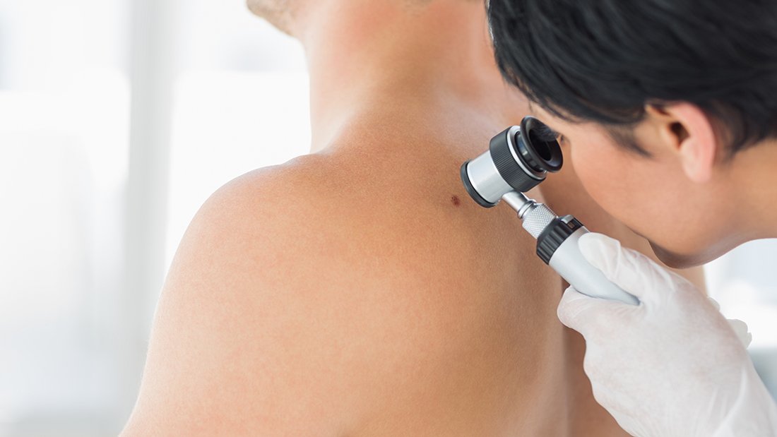 cirugia-para-cancer-de-piel