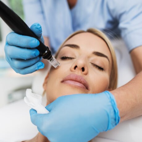 dermapen