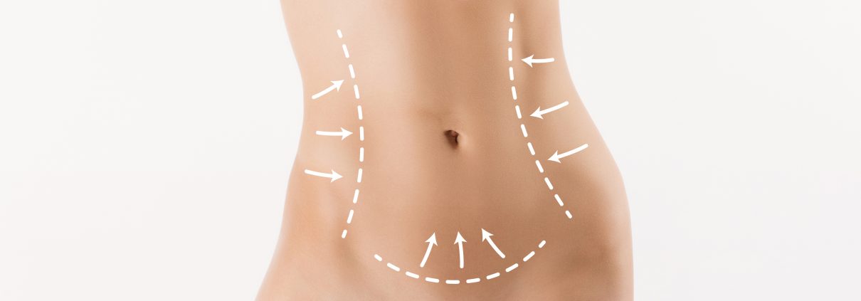 Body correction with the help of plastic surgery on white background
