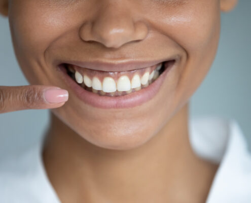 Cirugía de la Sonrisa Gingival | Todo lo que debes saber