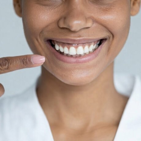 sonrisa gingival