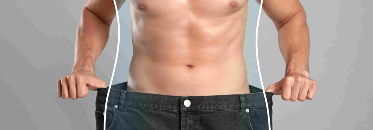 liposuccion en hombres