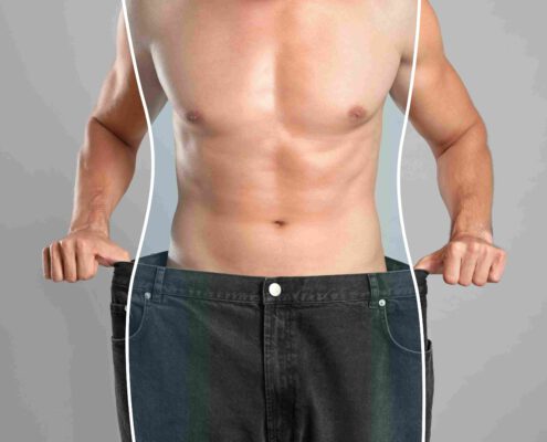 liposuccion en hombres