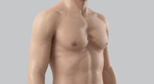 Pectus Excavatum: ¿Qué es, síntomas y tratamiento?