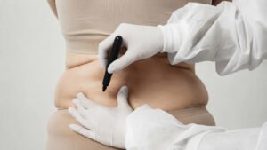 Descubre cuál es la diferencia entre liposucción y lipoescultura