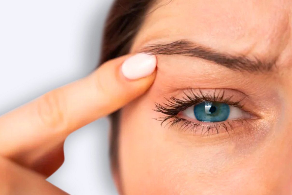 blefaroplastia-superior-santander-valladolid