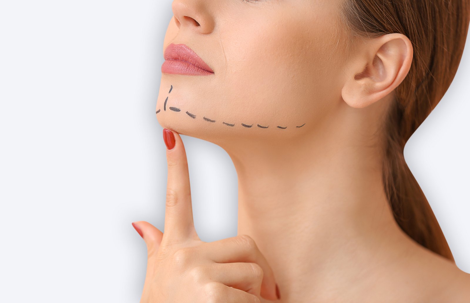 mentoplastia-cirugia-menton