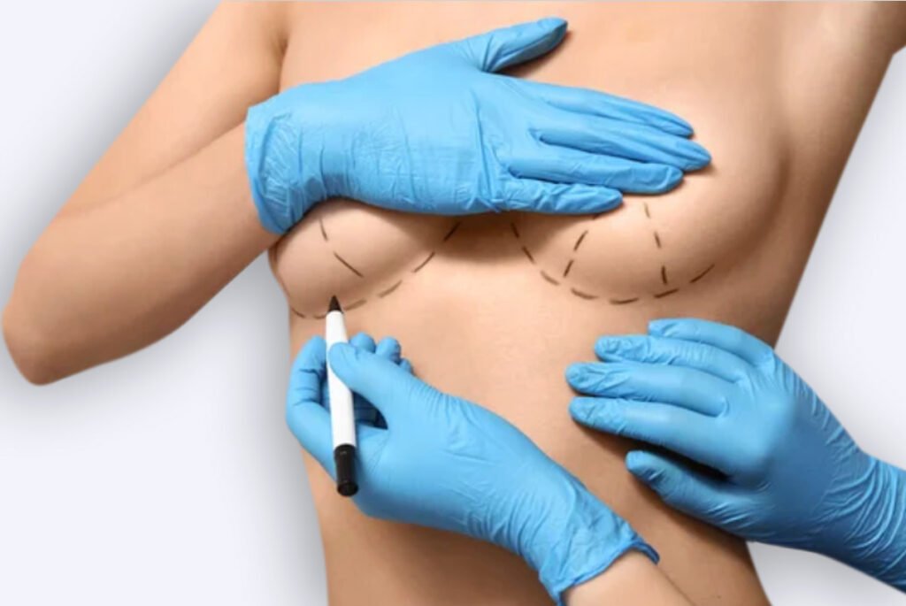 aumento-mamario-doctor-sanz-santander-valladolid