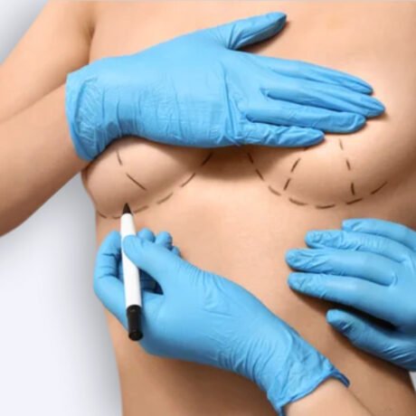 aumento-mamario-doctor-sanz-santander-valladolid