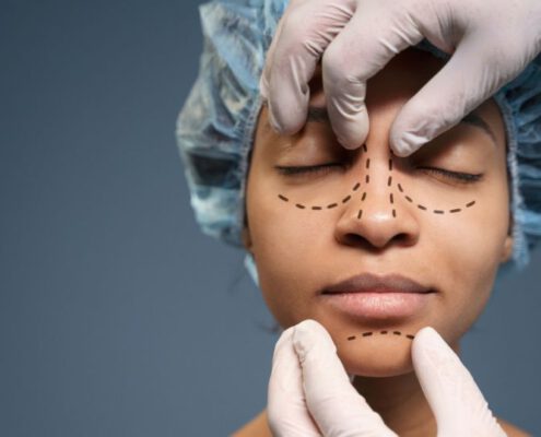 armonización facial