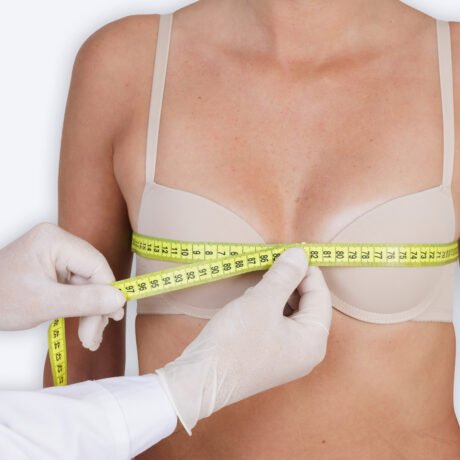 cirugía-reconstructiva-obesidad-mórbida