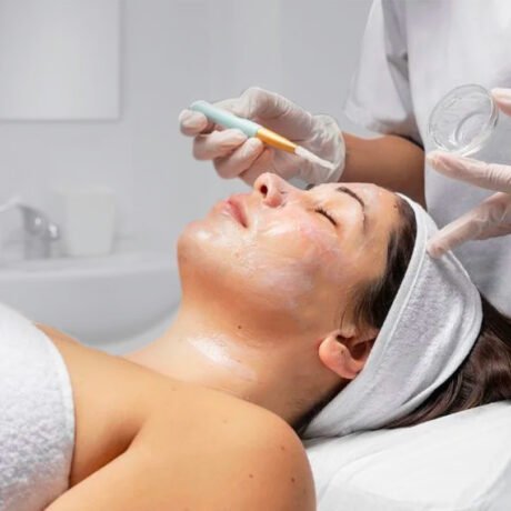 peeling-quimico-facial