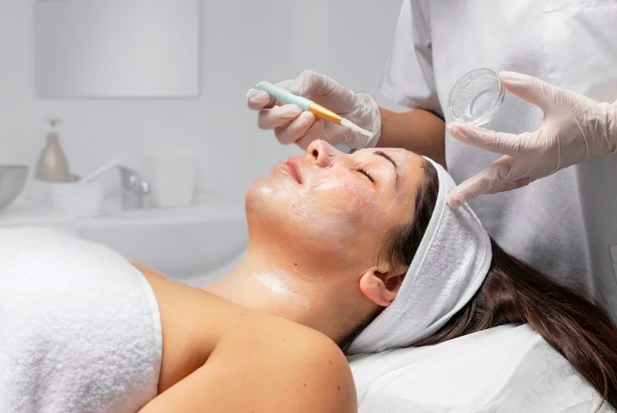 peeling quimico facial