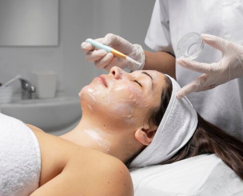peeling químico facial
