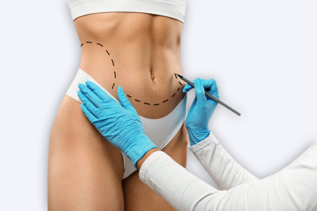 Abdominoplastia_cirugia
