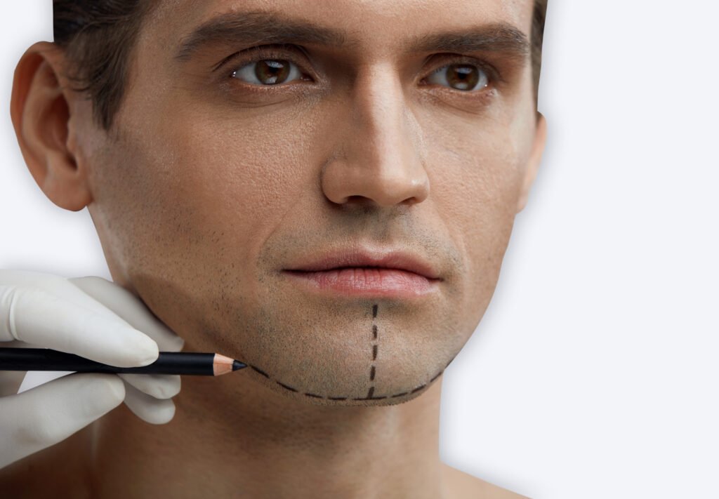 cirugía_menton_hombre