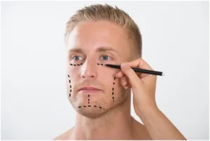 Top 5 de cirugías en hombres para mejorar su imagen