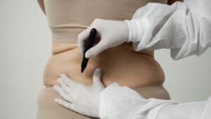Descubre cuál es la diferencia entre liposucción y lipoescultura