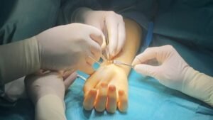 Todo sobre la fractura de los huesos del carpo: diagnóstico y tratamiento