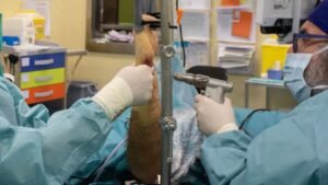 Comprendiendo las lesiones tendinosas: causas, diagnóstico y tratamiento