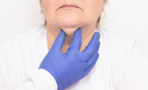 Liposucción de papada o liposuccion de cuello: todas las claves