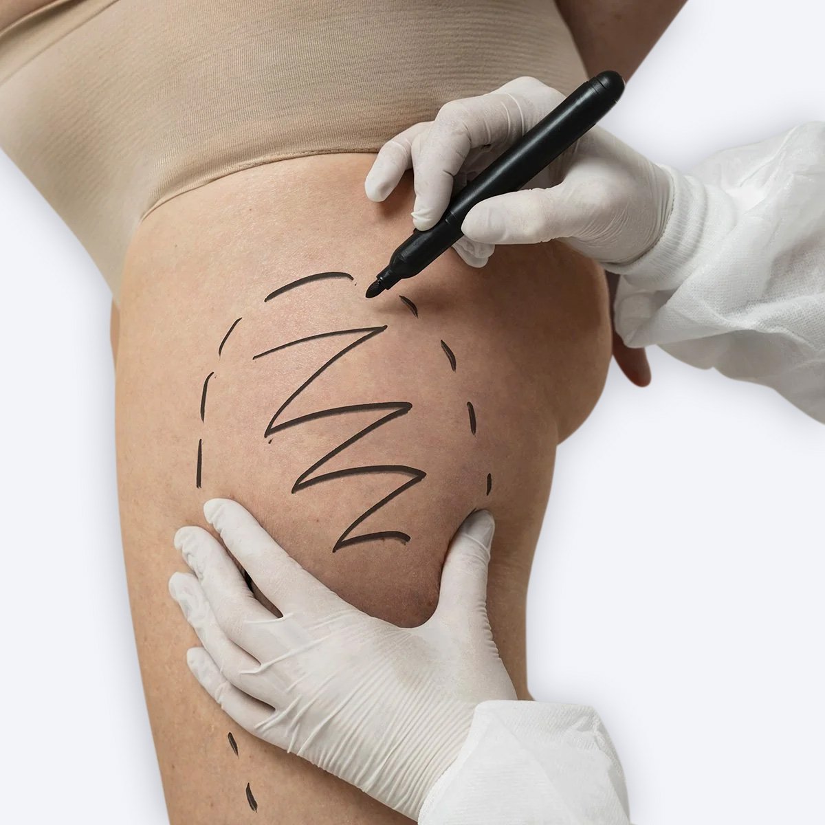  <span class="lte-header lte-h4"> 1.- Primera consulta: escuchar, comprender y planificar </span> 