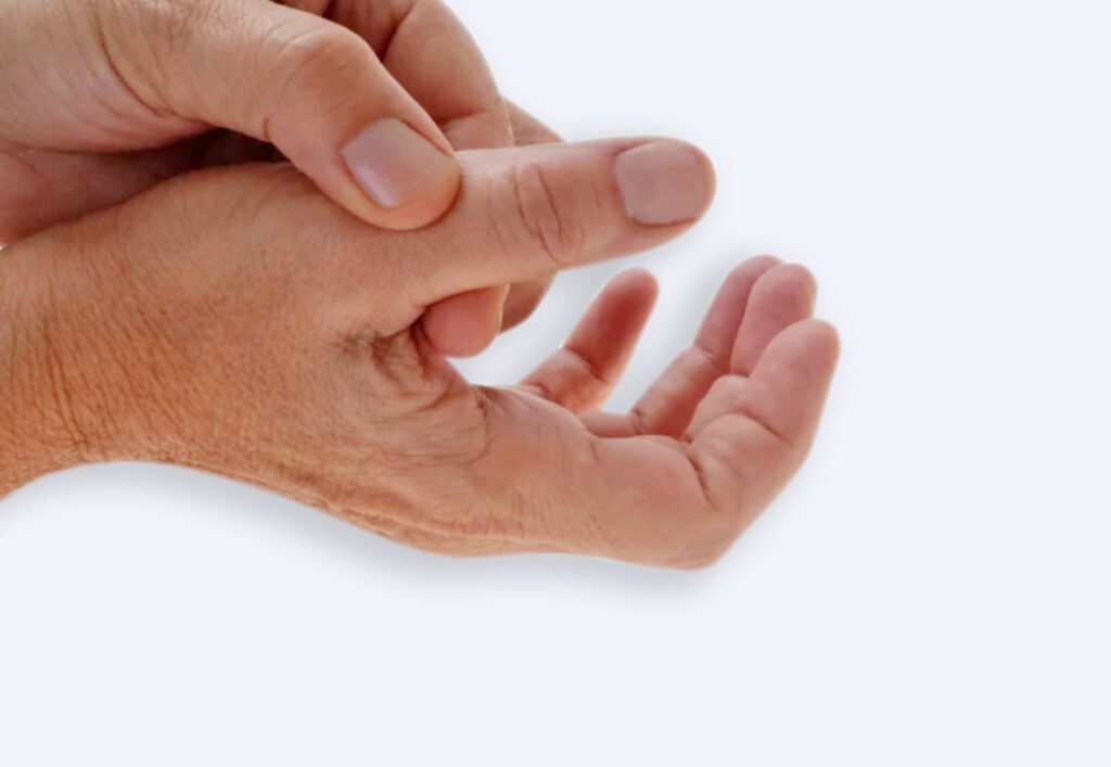 Artrosis de la mano, rizartrosis