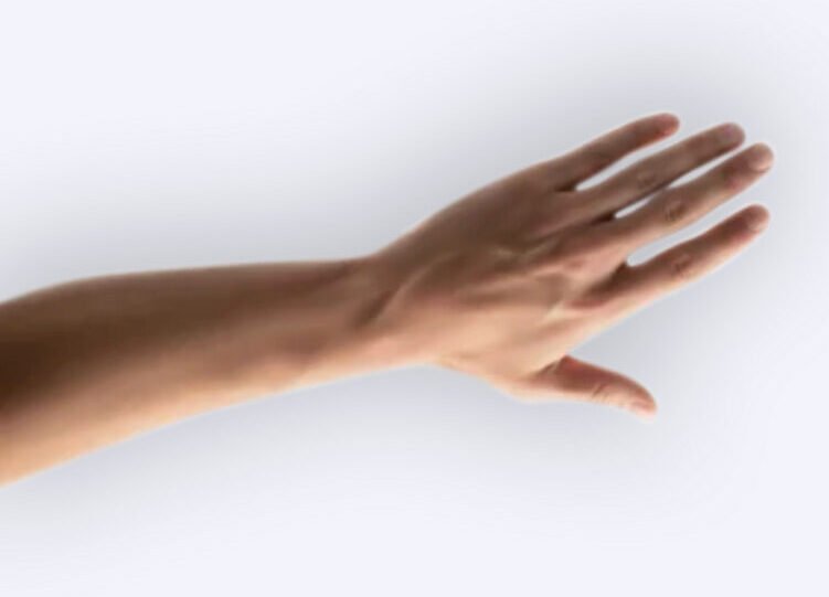 lesiones-ligamentosas-de-la-mano