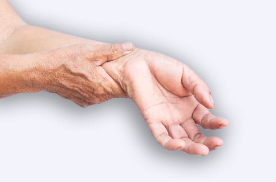 malformacion-vascular