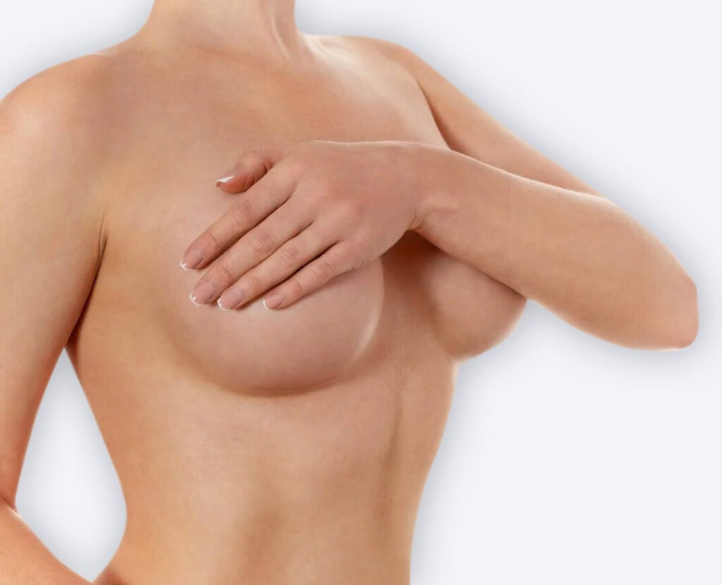 mamoplastia de aumento - aumento de pecho