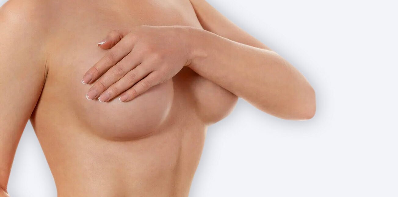 mamoplastia de aumento o aumento de pecho