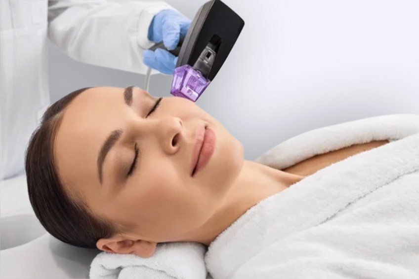 morpheus8-santander-valladolid