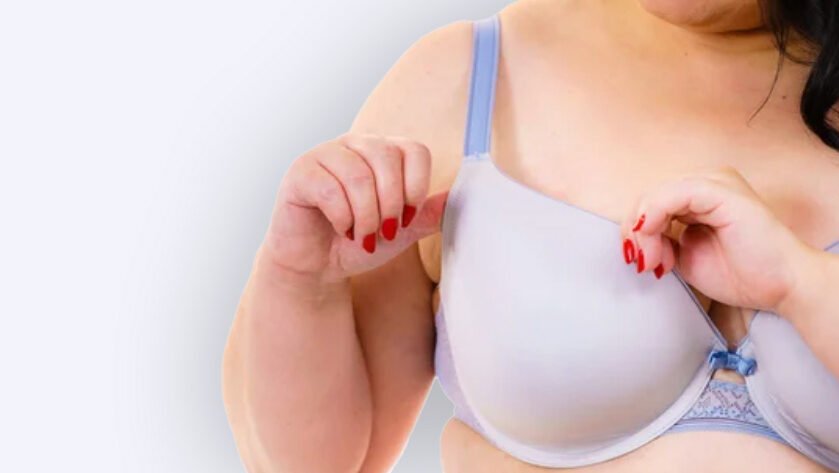 reducción-opecho-mujer