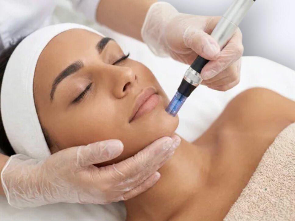 tratamientos-estéticos-faciales-sin-cirugia