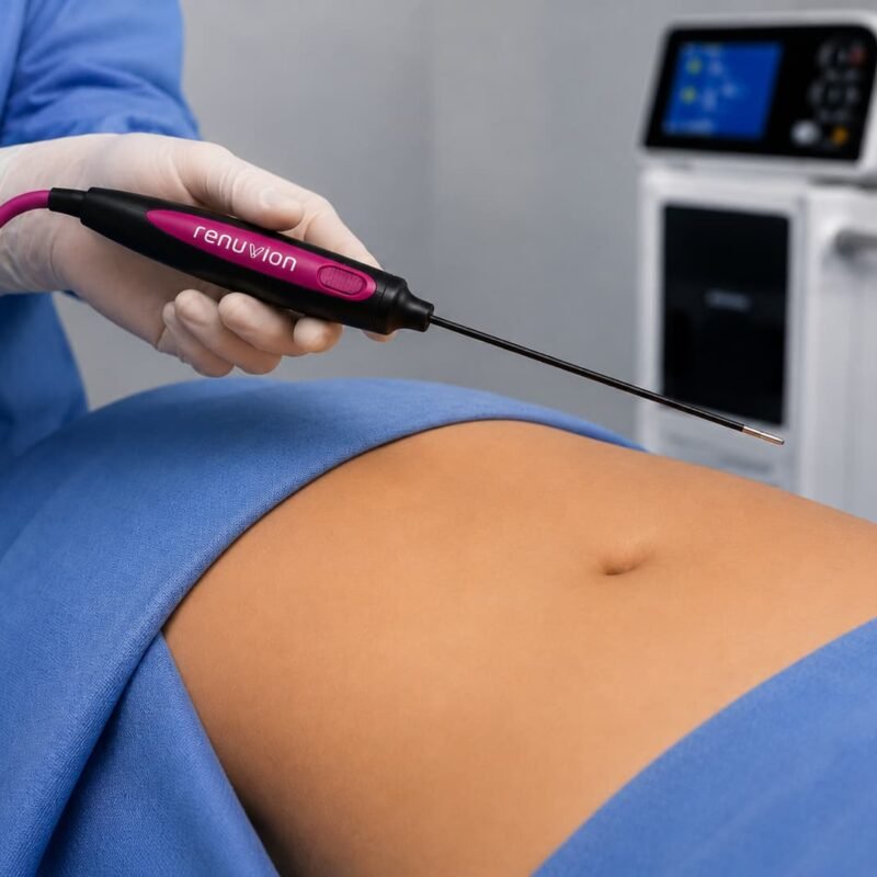 Renuvion y sus aplicaciones en cirugía estética