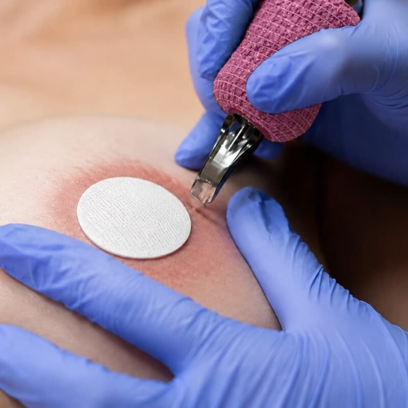 micropigmentación de areolas