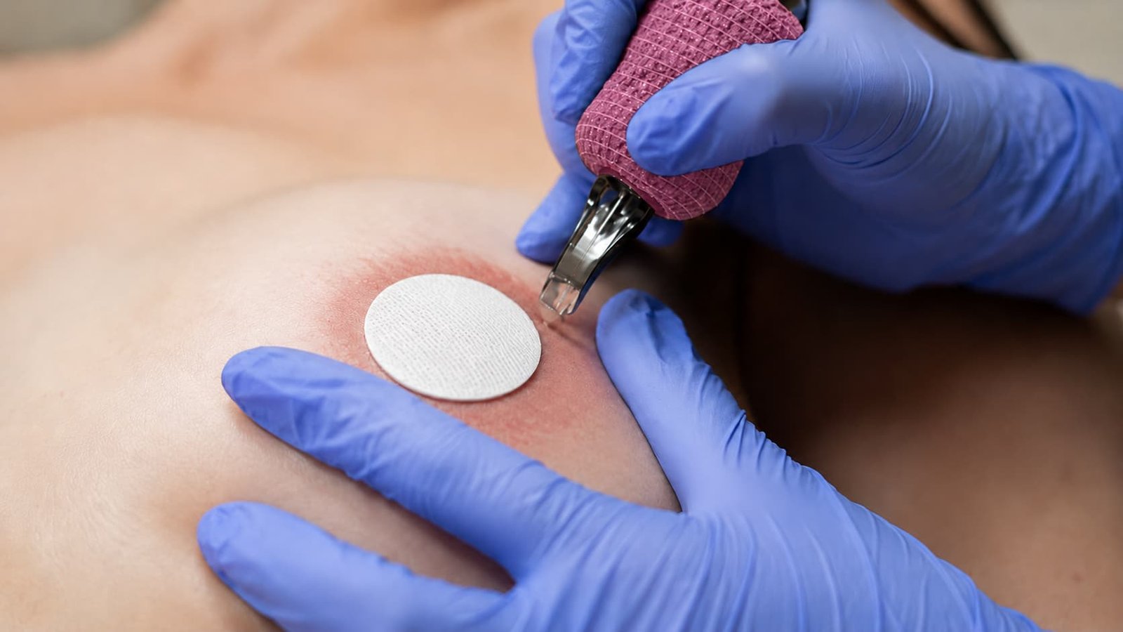micropigmentación de areolas
