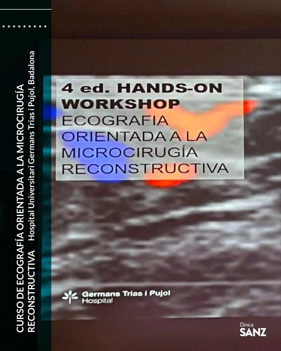 Ecografía aplicada a la microcirugía reconstructiva: formación del Dr. Sanz — fotografía 1